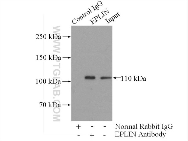 EPLIN Antibody in Immunoprecipitation (IP)