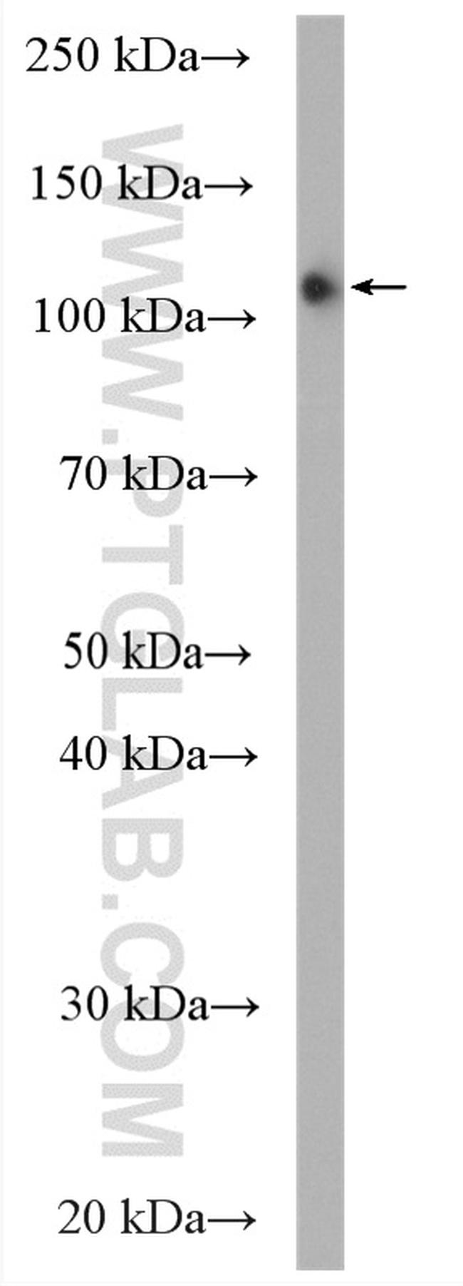 EPLIN Antibody in Western Blot (WB)