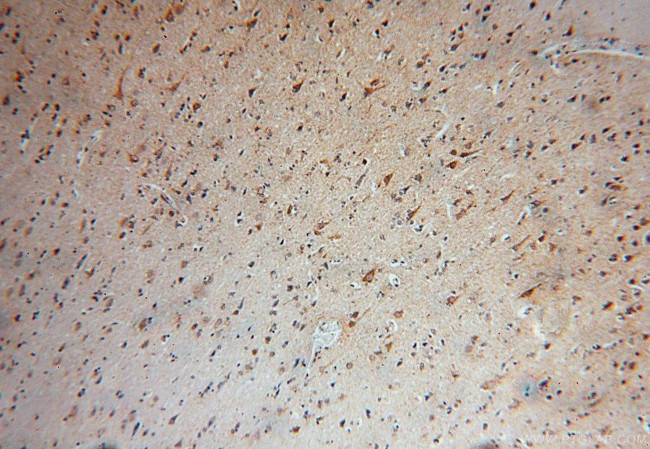 NDUFA5 Antibody in Immunohistochemistry (Paraffin) (IHC (P))