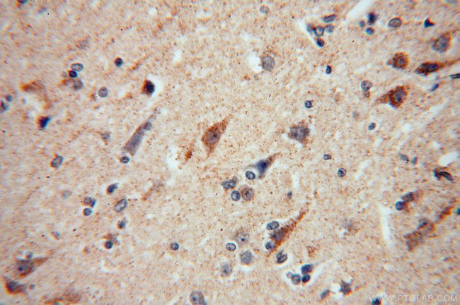 NDUFA5 Antibody in Immunohistochemistry (Paraffin) (IHC (P))