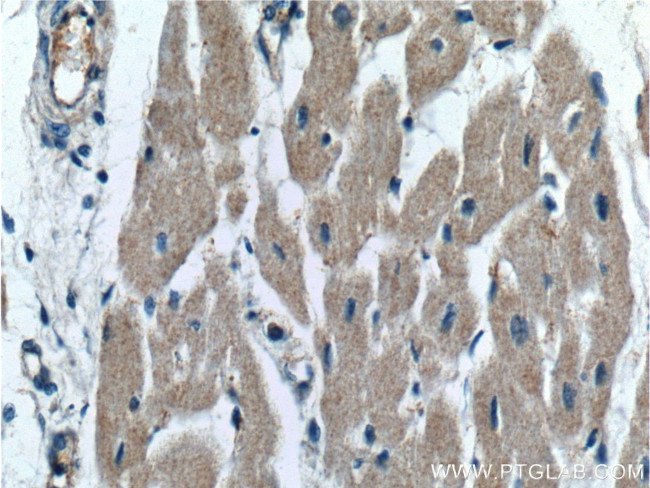 OXSM Antibody in Immunohistochemistry (Paraffin) (IHC (P))