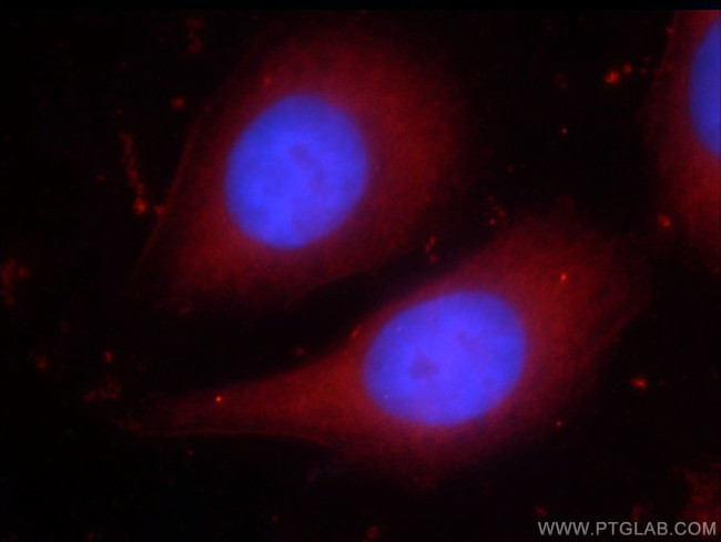 PPAR gamma Antibody in Immunocytochemistry (ICC/IF)