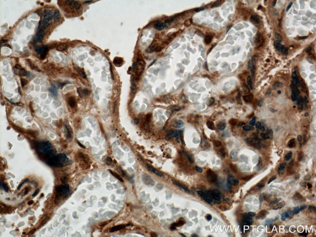 PPAR gamma Antibody in Immunohistochemistry (Paraffin) (IHC (P))