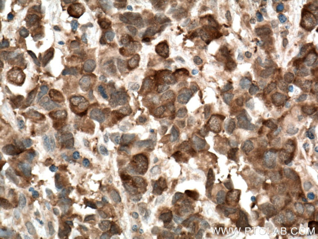 PPAR gamma Antibody in Immunohistochemistry (Paraffin) (IHC (P))