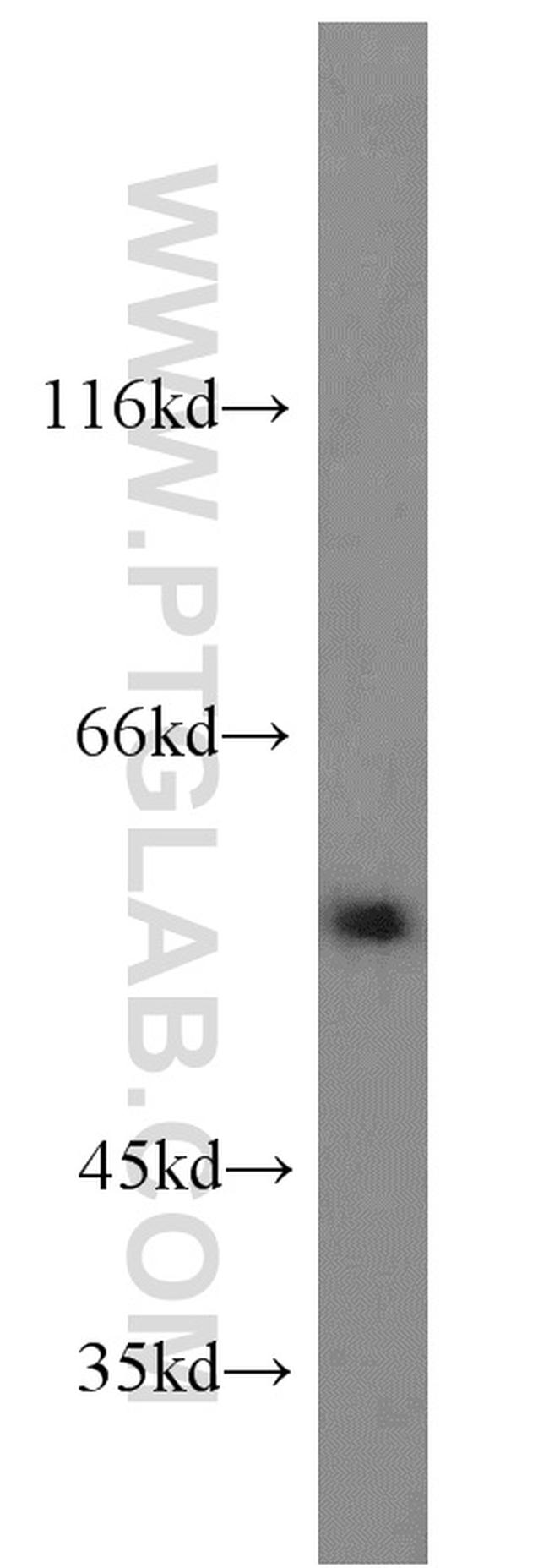 PPAR gamma Antibody in Western Blot (WB)