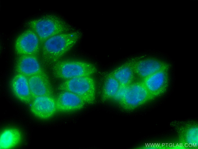 TIMP1 Antibody in Immunocytochemistry (ICC/IF)