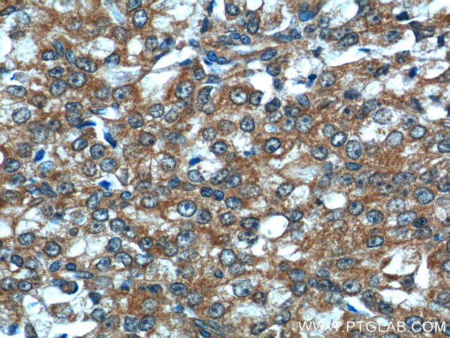 TIMP1 Antibody in Immunohistochemistry (Paraffin) (IHC (P))