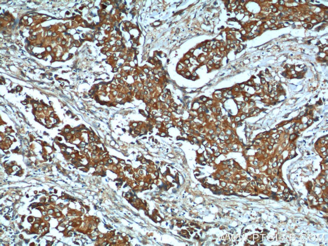 TIMP1 Antibody in Immunohistochemistry (Paraffin) (IHC (P))