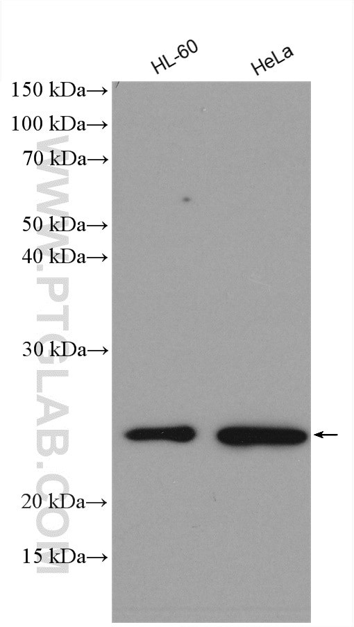 TIMP1 Antibody in Western Blot (WB)