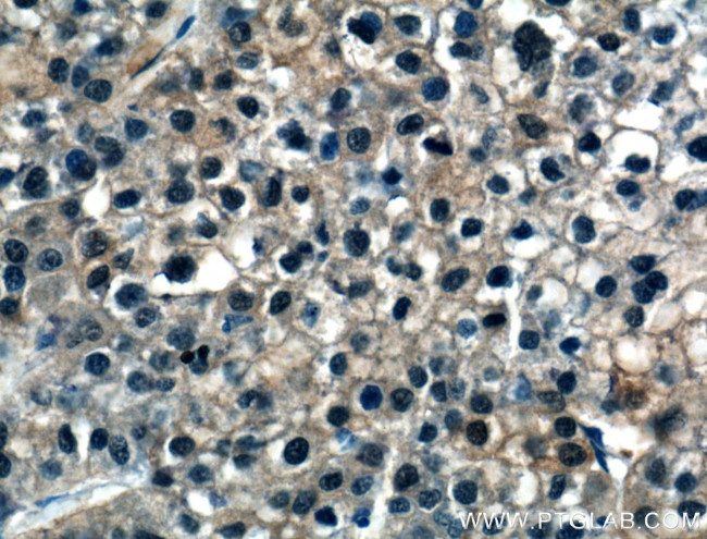 ASL Antibody in Immunohistochemistry (Paraffin) (IHC (P))