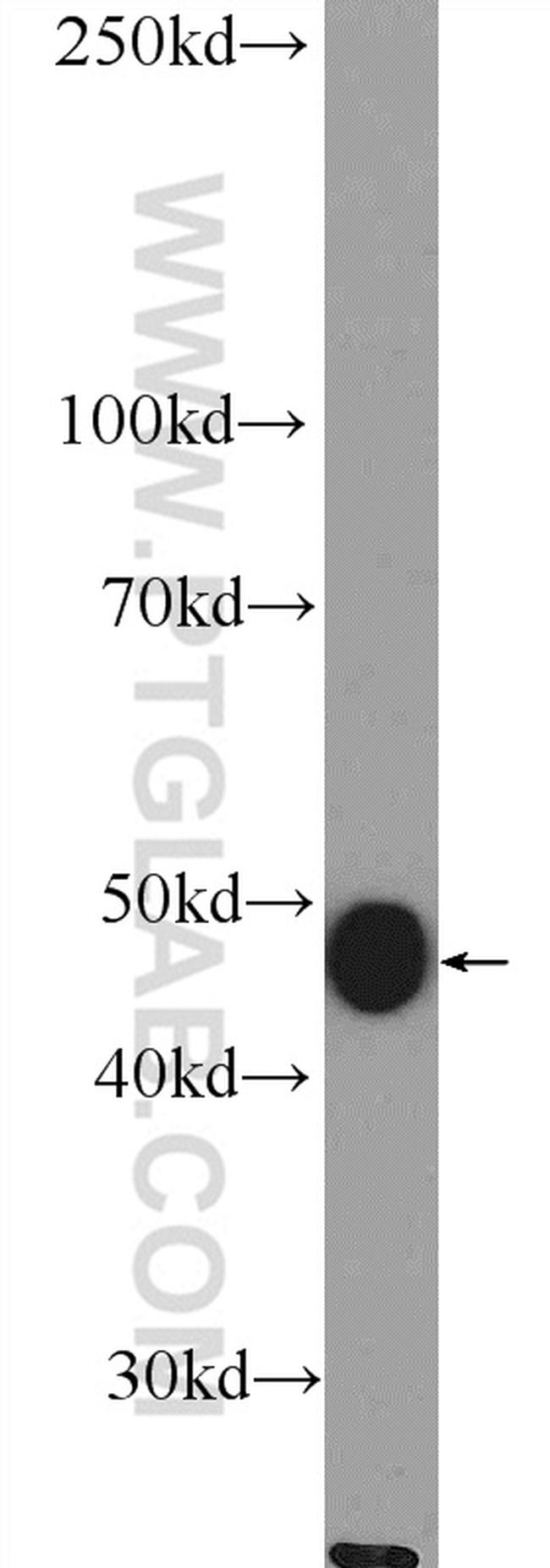 ASL Antibody in Western Blot (WB)