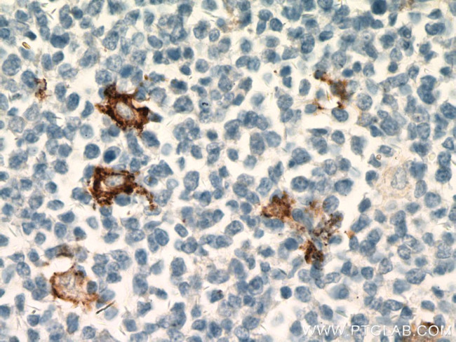 CD163 Antibody in Immunohistochemistry (Paraffin) (IHC (P))