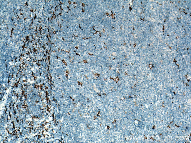 CD163 Antibody in Immunohistochemistry (Paraffin) (IHC (P))