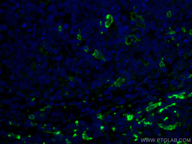 CD163 Antibody in Immunohistochemistry (PFA fixed) (IHC (PFA))