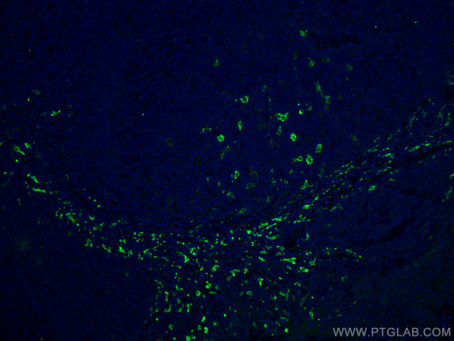 CD163 Antibody in Immunohistochemistry (PFA fixed) (IHC (PFA))