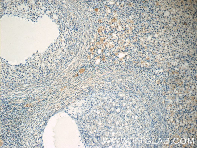 ZER1 Antibody in Immunohistochemistry (Paraffin) (IHC (P))