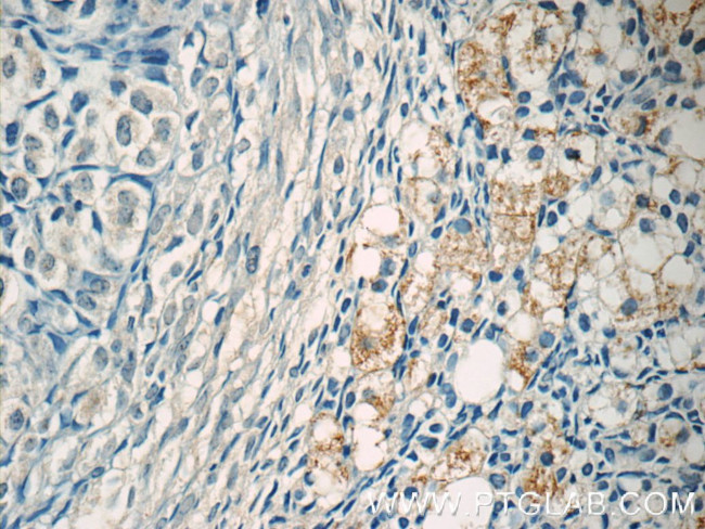 ZER1 Antibody in Immunohistochemistry (Paraffin) (IHC (P))