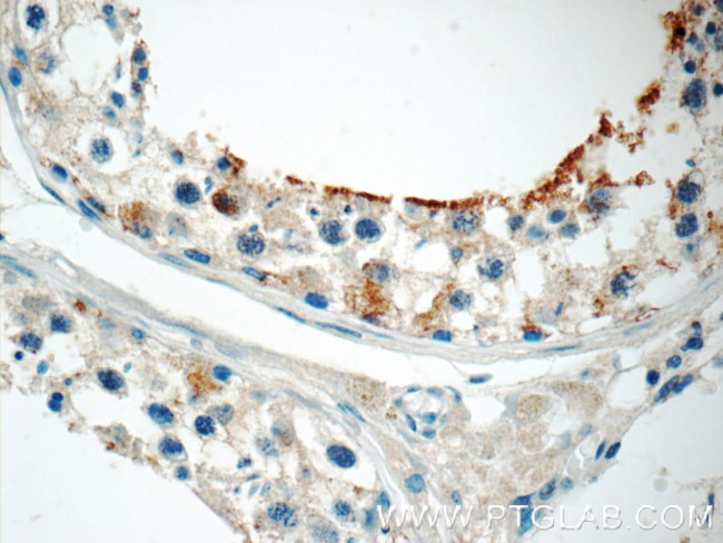 ZER1 Antibody in Immunohistochemistry (Paraffin) (IHC (P))