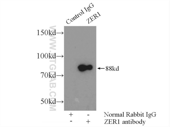 ZER1 Antibody in Immunoprecipitation (IP)