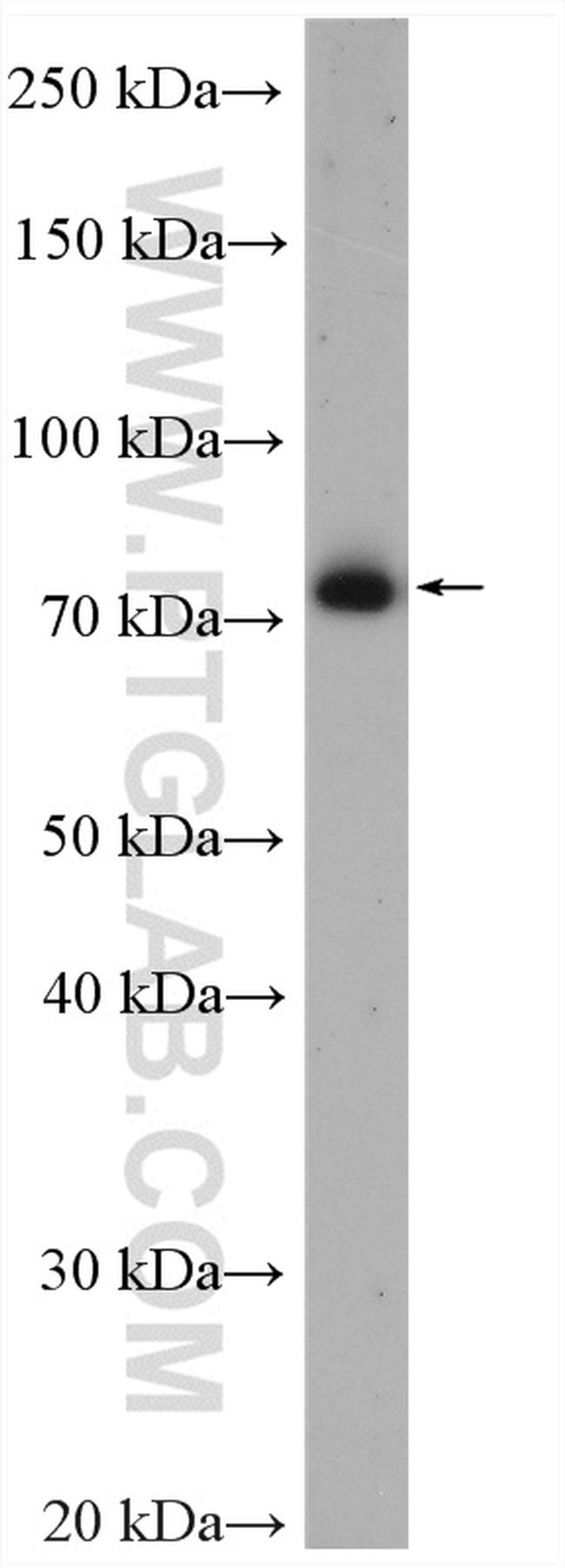 ZER1 Antibody in Western Blot (WB)