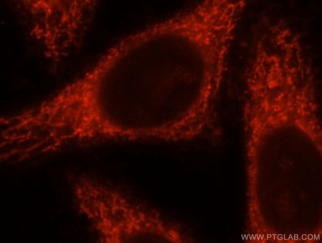 MRPL10 Antibody in Immunocytochemistry (ICC/IF)