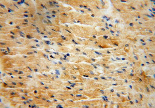 MRPL10 Antibody in Immunohistochemistry (Paraffin) (IHC (P))