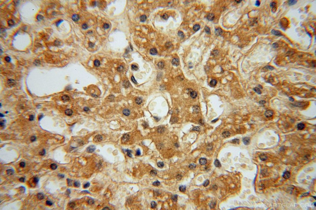 MRPL10 Antibody in Immunohistochemistry (Paraffin) (IHC (P))