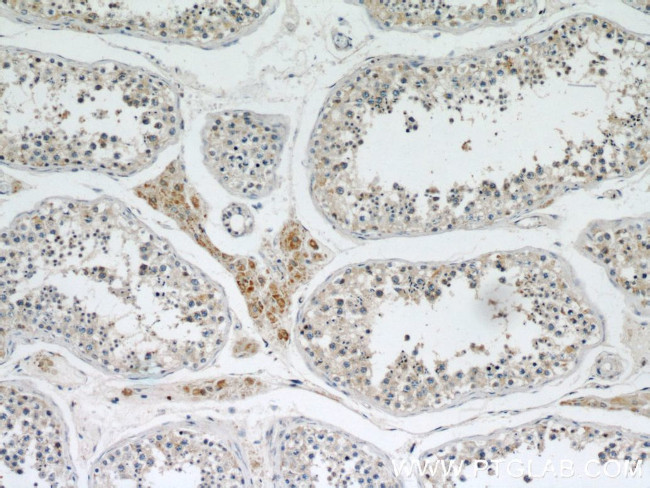 MRPL10 Antibody in Immunohistochemistry (Paraffin) (IHC (P))