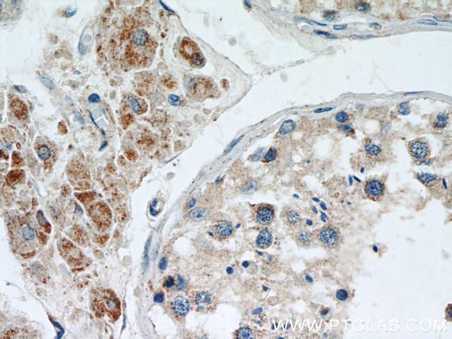 MRPL10 Antibody in Immunohistochemistry (Paraffin) (IHC (P))