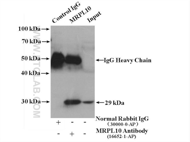 MRPL10 Antibody in Immunoprecipitation (IP)