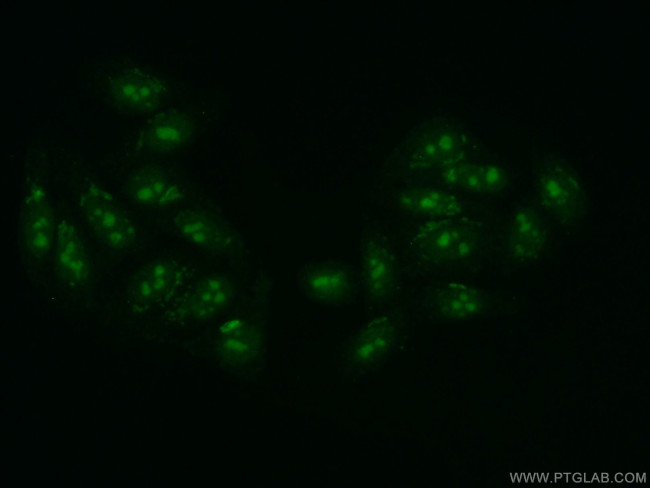 DDX52 Antibody in Immunocytochemistry (ICC/IF)