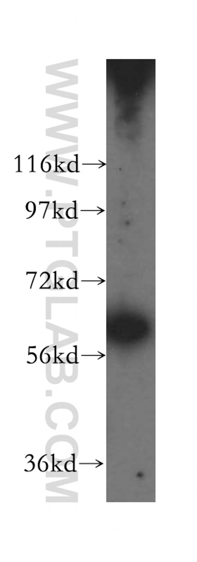 DDX52 Antibody in Western Blot (WB)