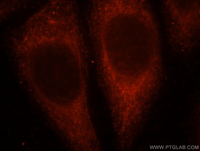 UGT2B7 Antibody in Immunocytochemistry (ICC/IF)