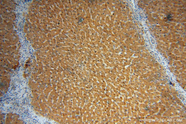 UGT2B7 Antibody in Immunohistochemistry (Paraffin) (IHC (P))