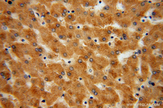 UGT2B7 Antibody in Immunohistochemistry (Paraffin) (IHC (P))