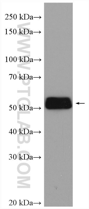 UGT2B7 Antibody in Western Blot (WB)