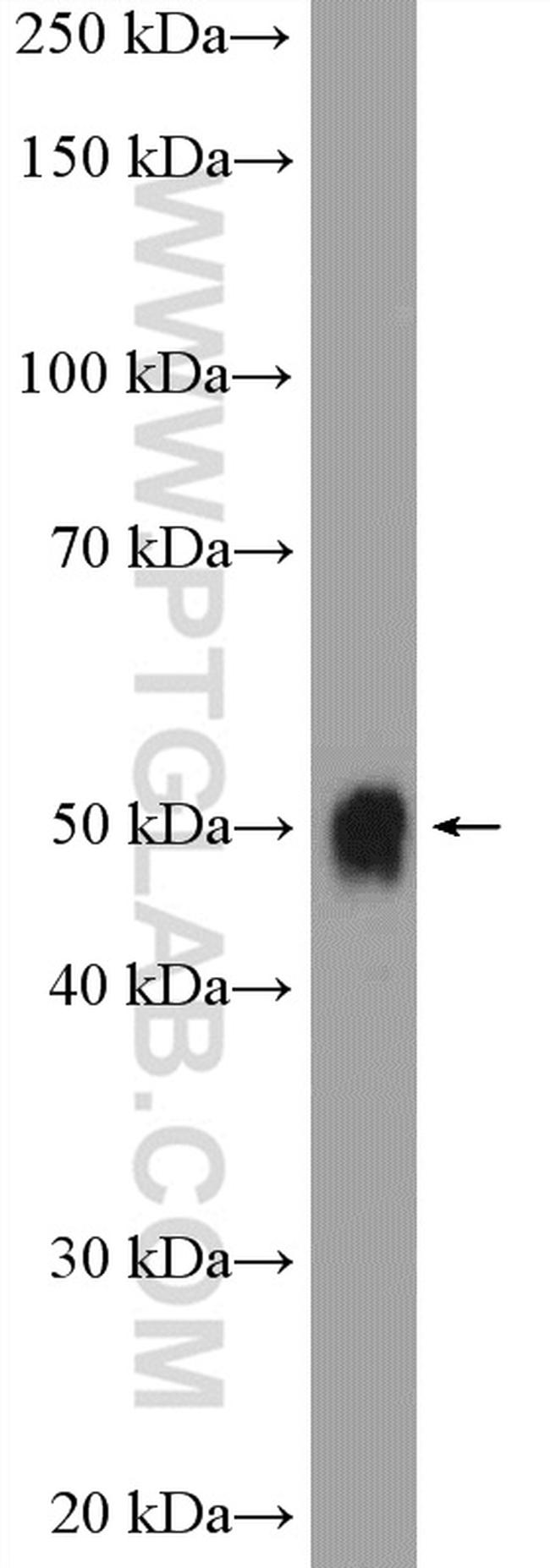 UGT2B7 Antibody in Western Blot (WB)
