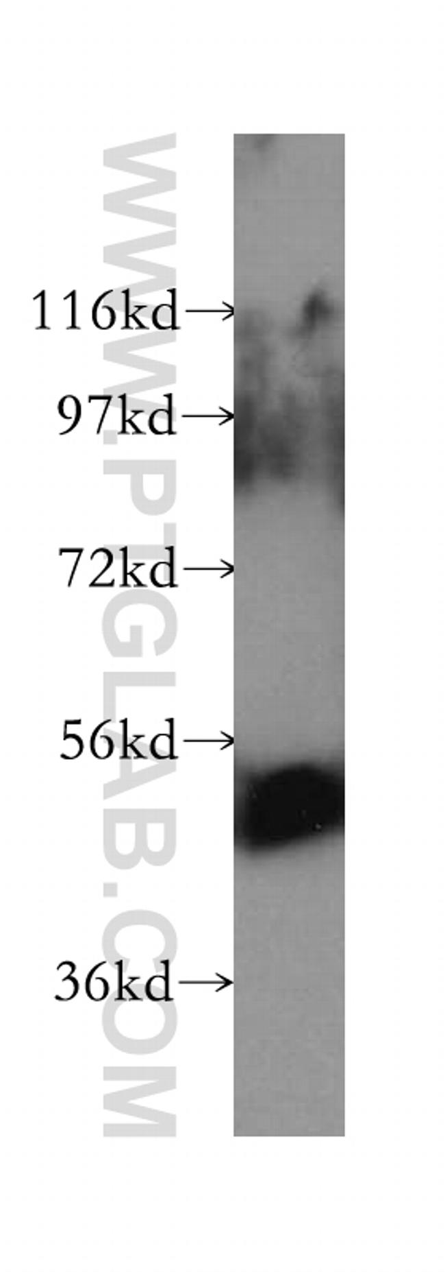 UGT2B7 Antibody in Western Blot (WB)