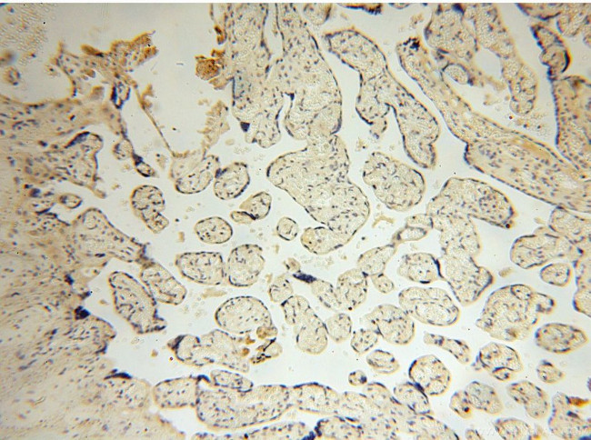 PPA2 Antibody in Immunohistochemistry (Paraffin) (IHC (P))