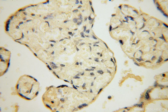 PPA2 Antibody in Immunohistochemistry (Paraffin) (IHC (P))