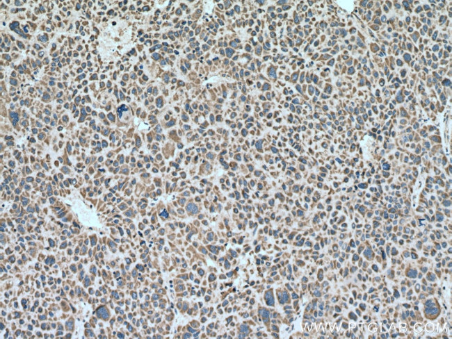 PPA2 Antibody in Immunohistochemistry (Paraffin) (IHC (P))