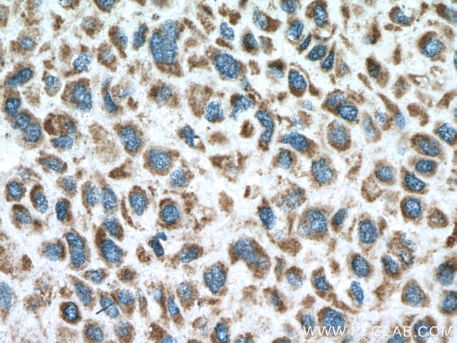 PPA2 Antibody in Immunohistochemistry (Paraffin) (IHC (P))