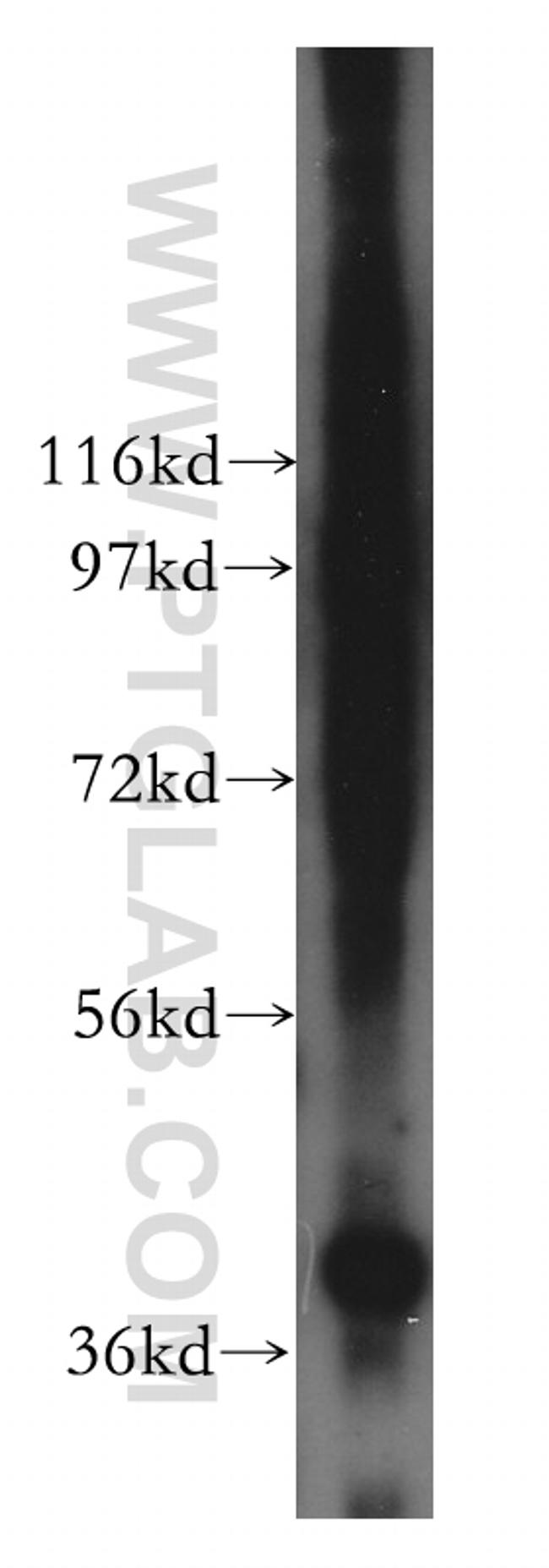 PPA2 Antibody in Western Blot (WB)