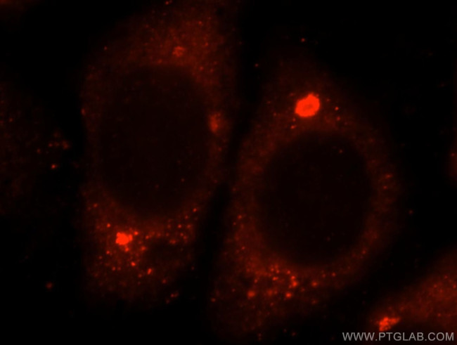 GTDC1 Antibody in Immunocytochemistry (ICC/IF)