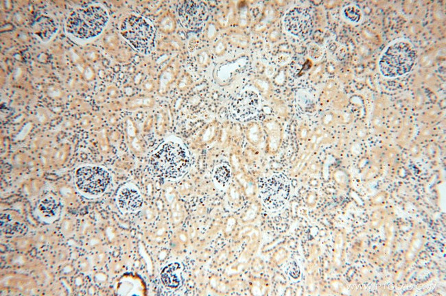 GTDC1 Antibody in Immunohistochemistry (Paraffin) (IHC (P))