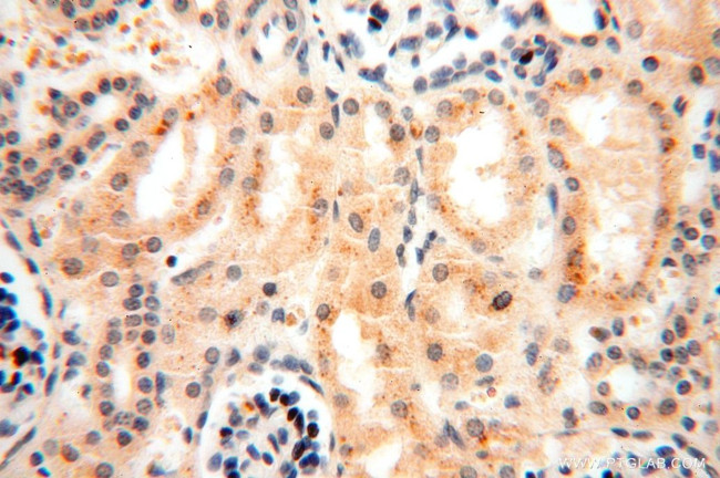 GTDC1 Antibody in Immunohistochemistry (Paraffin) (IHC (P))