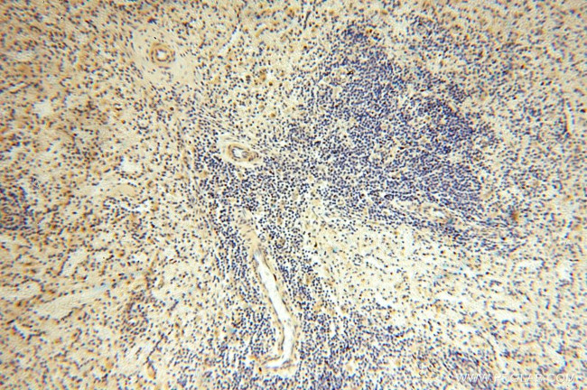 GTDC1 Antibody in Immunohistochemistry (Paraffin) (IHC (P))