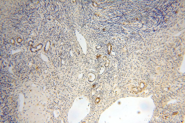 GTDC1 Antibody in Immunohistochemistry (Paraffin) (IHC (P))