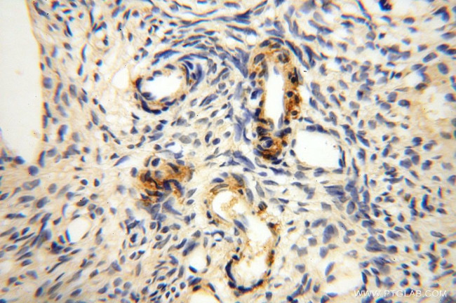 GTDC1 Antibody in Immunohistochemistry (Paraffin) (IHC (P))