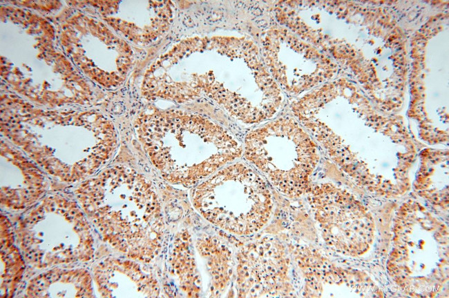 GTDC1 Antibody in Immunohistochemistry (Paraffin) (IHC (P))